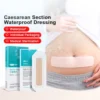 Transparent Waterproof Sterile Wound Dressing
