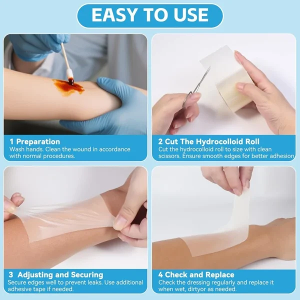 sg-11134201-7rdxi-mdah4s0pygtz8a Hydrocolloid Wound Care Tape Roll